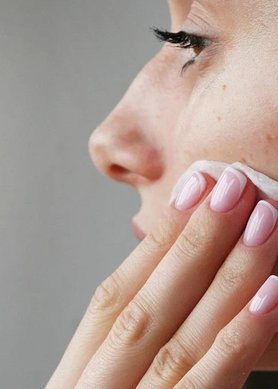 oplossingen-hormonale-acne