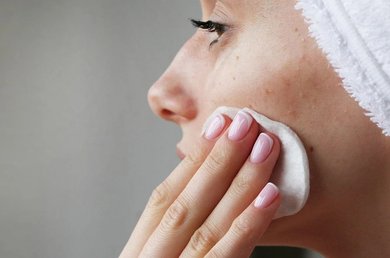 oplossingen-hormonale-acne