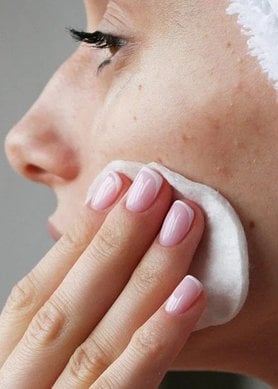 oplossingen-hormonale-acne