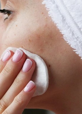 oplossingen-hormonale-acne