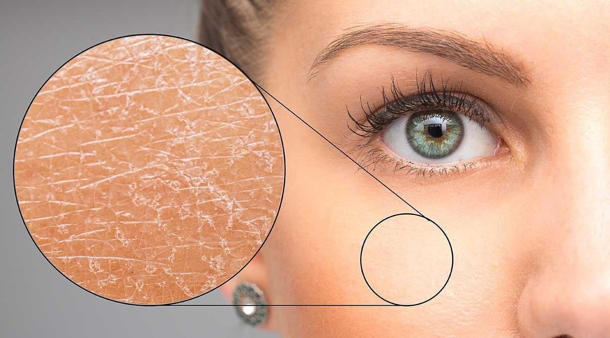 wat-doet-een-moisturizer-voor-je-huid-2