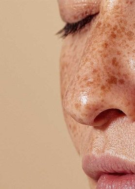 waarom-kiezen-voor-een-gezichtscreme-met-spf